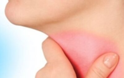 Las bajas temperaturas pueden provocar dolores de garganta .