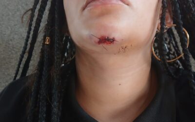 ITUZAINGO: DENUNCIAN VIOLENTA AGRESION A TRES PERSONAS EN UN BAR